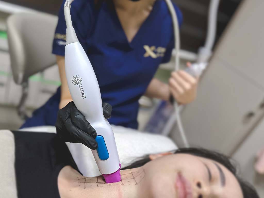 Tighten Saggy Neck Skin with Non-Surgical Treatment: THERMAGE FLX